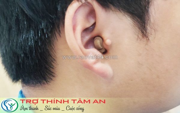 Máy trợ thính, máy trợ thính trong tai cic