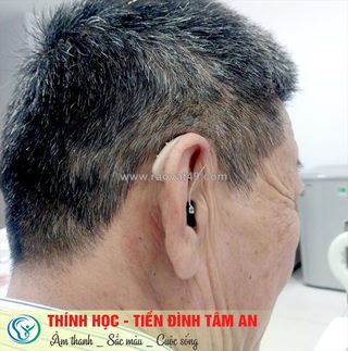 Máy trợ thính pure, máy trợ thính tâm an