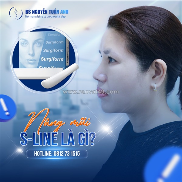 Nâng mũi s-line phù hợp với dáng mặt như thế nào?