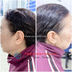 Tìm mua máy trợ thính tốt,chính hãng thanh hóa.