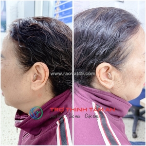 Tìm mua máy trợ thính tốt,chính hãng thanh hóa.