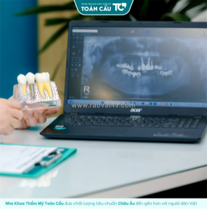 Trồng răng implant có vĩnh viễn không? tuổi thọ implant thực tế là bao lâu?