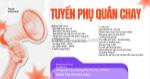 Tuyển nv phụ quán chay tân phú