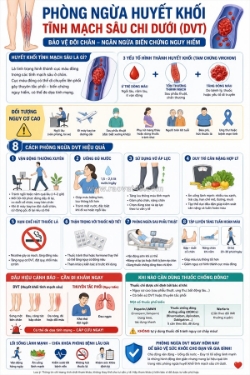 Tìm hiểu cách phòng ngừa huyết khối tĩnh mạch sâu chi dưới