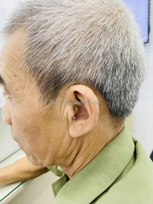 Máy trợ thính bí mật dành cho người thích sự kín đáo