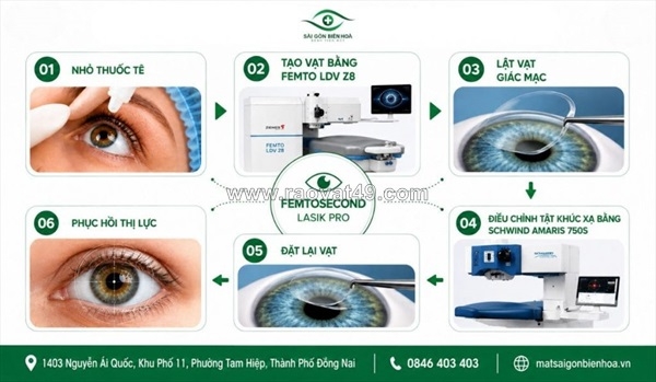 ~/Img/2026/6/phau-thuat-lasik-co-che-bang-gia-va-quy-trinh-khep-kin-01.jpg