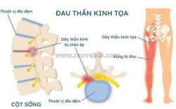 Phòng khám an thái – đồng hành cùng người bệnh xương khớp