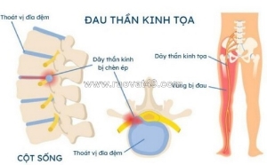 Phòng khám an thái – đồng hành cùng người bệnh xương khớp
