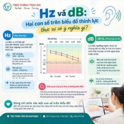 Hz và db trên biểu đồ thính lực có ý nghĩa gì?