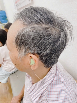 Ù tai nhưng không đi khám